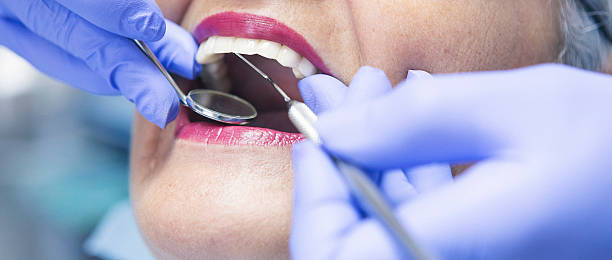 Best Emergency Treatment for Toothache in Desloge, MO